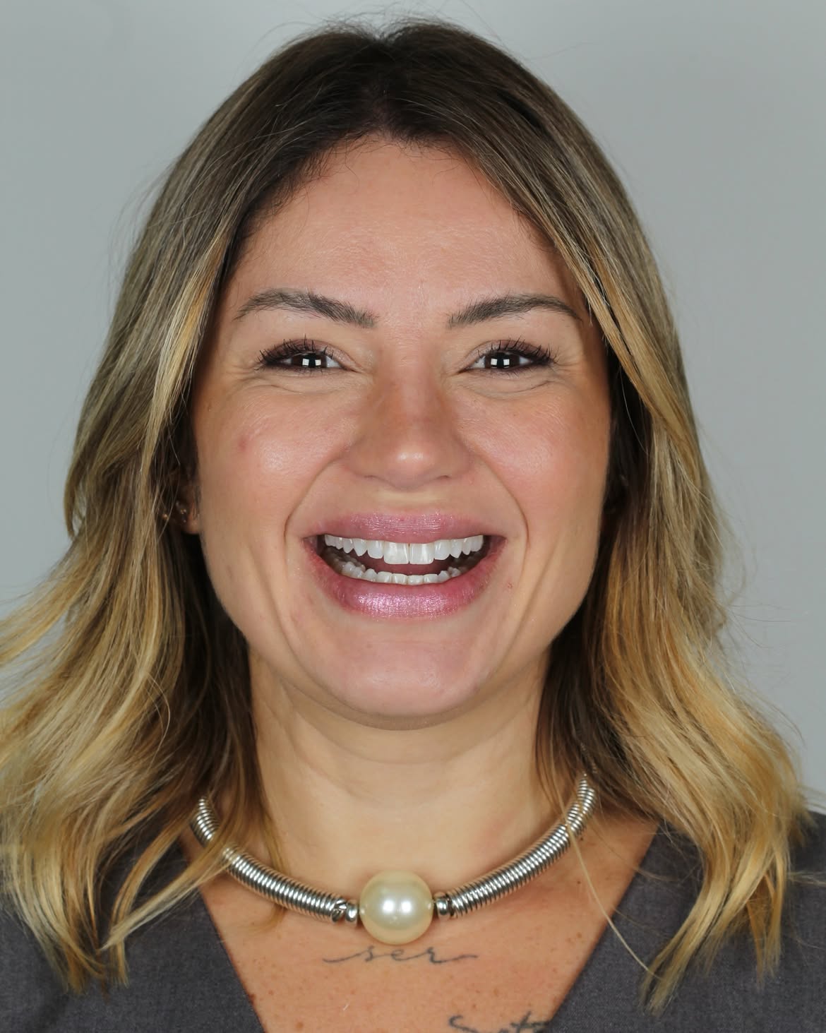 Close do sorriso com luz natural, mostrando textura e qualidade do trabalho GS Odontologia